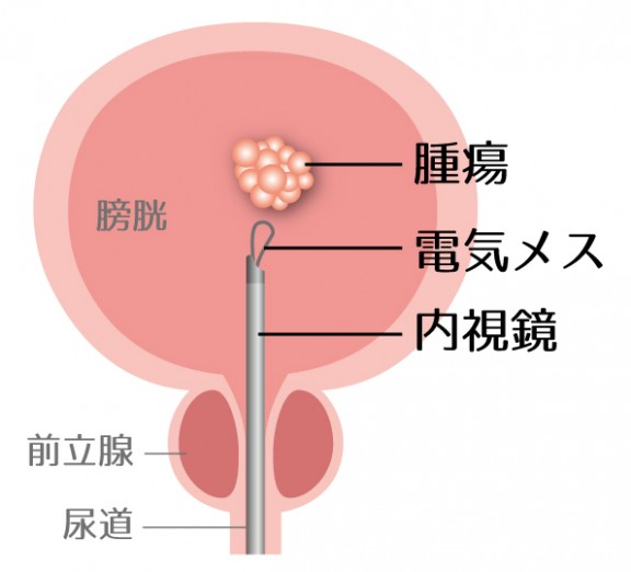 図12