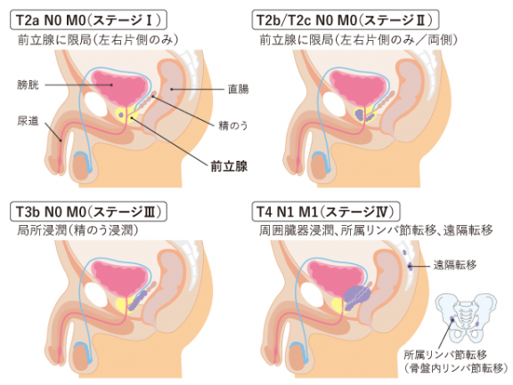 図16