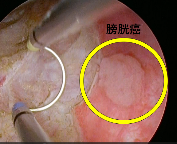 図17軽