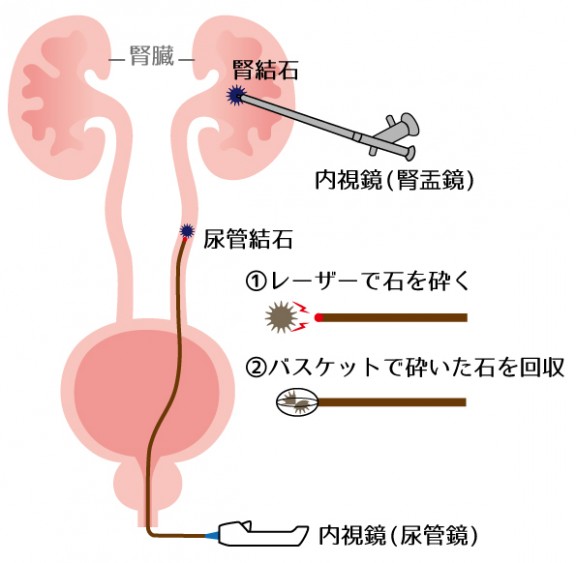 図22